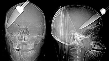 Unreal X-Ray Pictures
