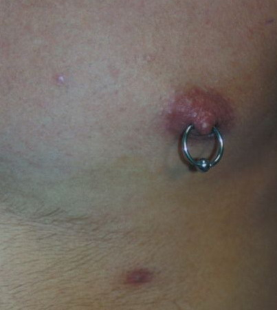 3rd Nipple Piercings