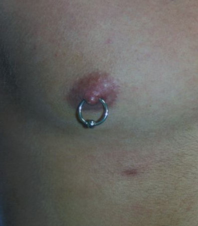 3rd Nipple Piercings