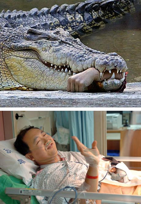 Crocodile Eats Hand