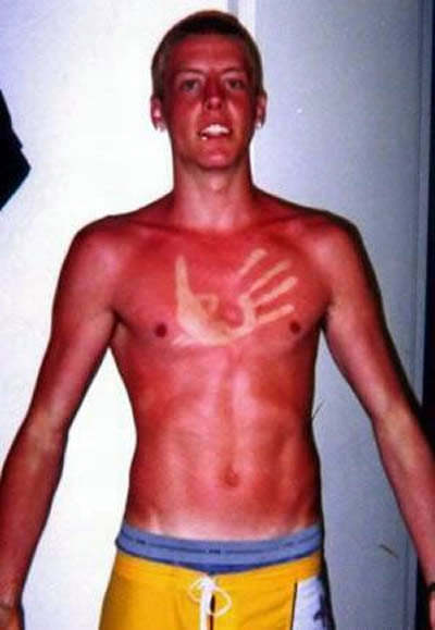 Worst Tan Disasters