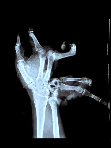 Unreal X-Ray Pictures