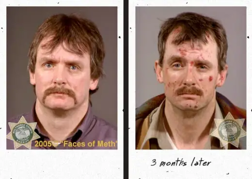 Faces Of Meth