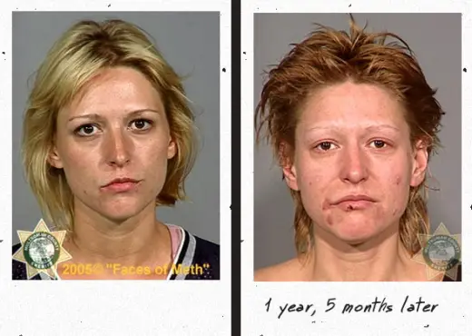 Faces Of Meth