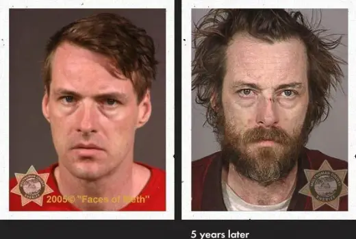 Meth Faces