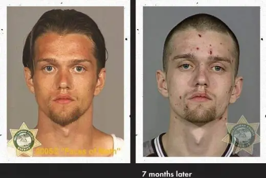 Meth Faces