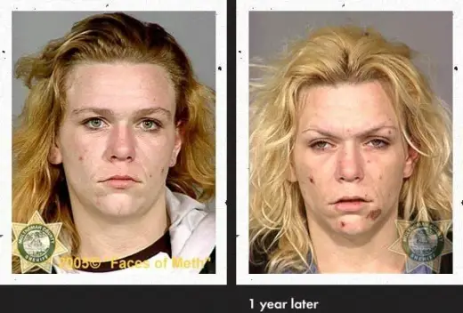 Meth Faces