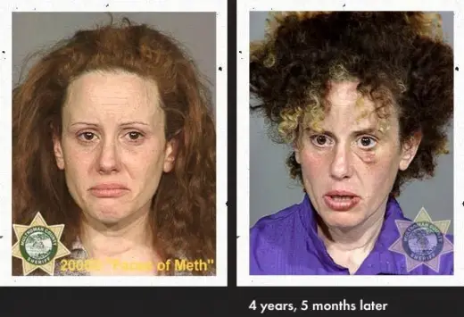 Meth Faces