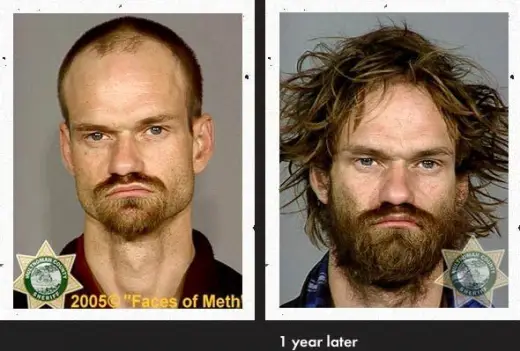 Meth Faces