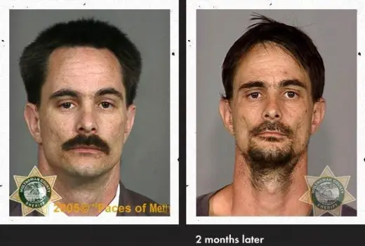 Meth Faces