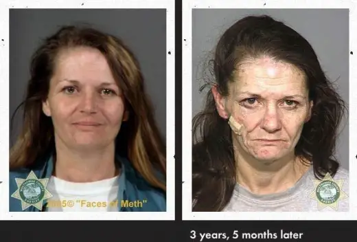 Meth Faces